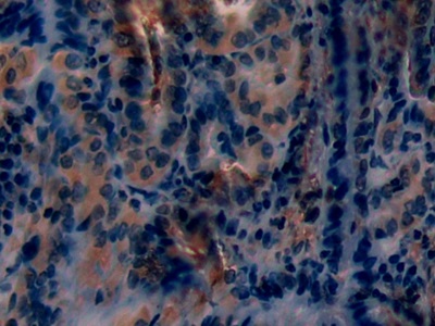 Immunohistochemistry (Formalin/PFA-fixed paraffin-embedded sections) - Anti-PKC epsilon antibody (AB233292), expandable thumbnail