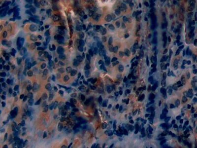 Immunohistochemistry (Formalin/PFA-fixed paraffin-embedded sections) - Anti-PKC epsilon antibody (AB233292)