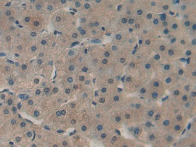 Immunohistochemistry (Formalin/PFA-fixed paraffin-embedded sections) - Anti-PKC epsilon antibody (AB233292), expandable thumbnail