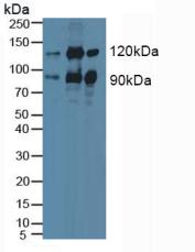 Western blot - Anti-PKC epsilon antibody (ab233292), expandable thumbnail