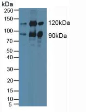 Western blot - Anti-PKC epsilon antibody (AB233292)