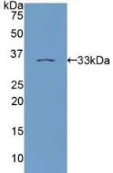 Western blot - Anti-PKC epsilon antibody (AB233292)