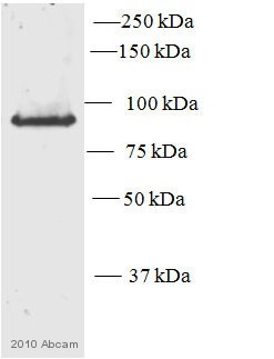 Western blot - Anti-PKC epsilon antibody (AB63638)