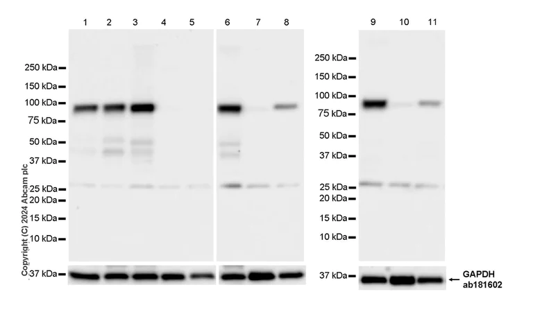 Western blot - Anti-PKC epsilon antibody [EPR28194-50] - BSA and Azide free (AB317499)