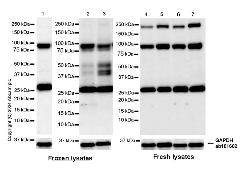 Western blot - Anti-PKC epsilon antibody [EPR28194-50] - BSA and Azide free (AB317499)