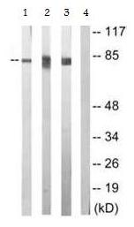 Western blot - Anti-PKC epsilon (phospho S729) antibody (AB63387)