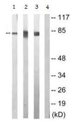 Western blot - Anti-PKC epsilon (phospho S729) antibody (AB63387)