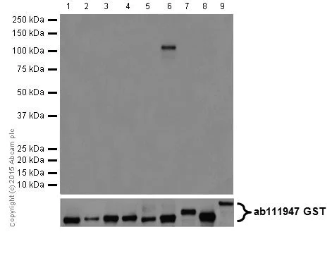 Western blot - Anti-PKC eta antibody [EPR18513] (AB179524)