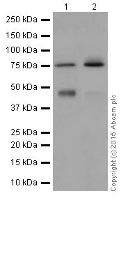 Western blot - Anti-PKC eta antibody [EPR18513] (AB179524)