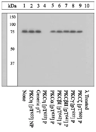 Western blot - Anti-PKC eta (phospho T655) antibody (AB5798)
