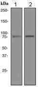 Western blot - Anti-PKC gamma antibody [EPR2750] (AB108961), expandable thumbnail