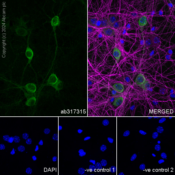 Immunocytochemistry/ Immunofluorescence - Anti-PKC gamma antibody [EPR28643-68] (ab317315), expandable thumbnail