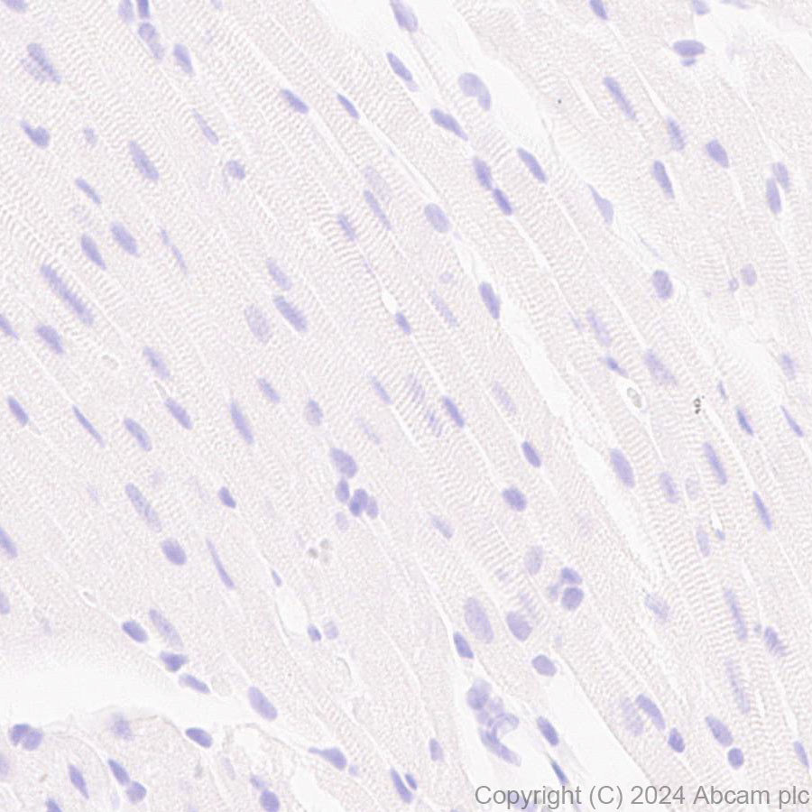 Immunohistochemistry (Formalin/PFA-fixed paraffin-embedded sections) - Anti-PKC gamma antibody [EPR28643-68] (ab317315), expandable thumbnail