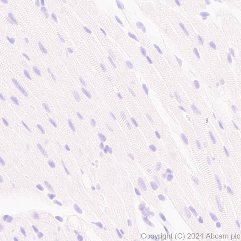 Immunohistochemistry (Formalin/PFA-fixed paraffin-embedded sections) - Anti-PKC gamma antibody [EPR28643-68] (AB317315)