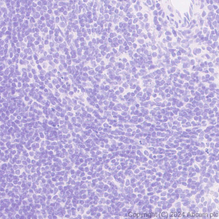Immunohistochemistry (Formalin/PFA-fixed paraffin-embedded sections) - Anti-PKC gamma antibody [EPR28643-68] (AB317315)