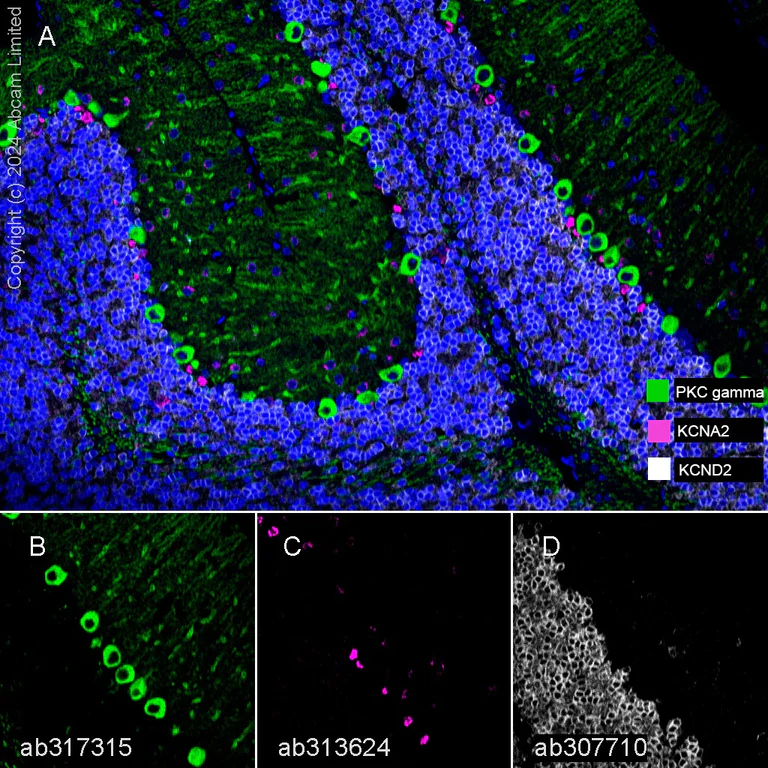 Multiplex immunohistochemistry - Anti-PKC gamma antibody [EPR28643-68] (AB317315)