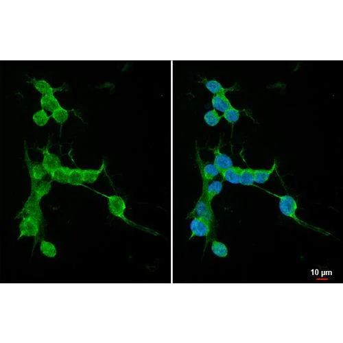Immunocytochemistry/ Immunofluorescence - Anti-PKC gamma antibody [HL2227] (AB317171)