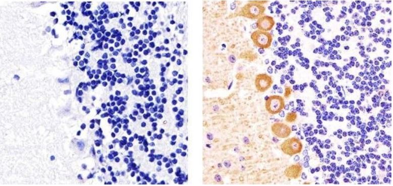 Immunohistochemistry (Formalin/PFA-fixed paraffin-embedded sections) - Anti-PKC gamma (phospho T655) antibody (AB5796)