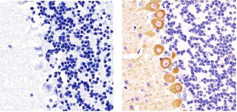 Immunohistochemistry (Formalin/PFA-fixed paraffin-embedded sections) - Anti-PKC gamma (phospho T655) antibody (AB5796)