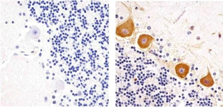 Immunohistochemistry (Formalin/PFA-fixed paraffin-embedded sections) - Anti-PKC gamma (phospho T655) antibody (AB5796)