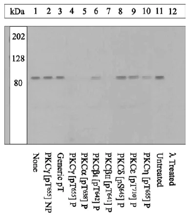 Western blot - Anti-PKC gamma (phospho T655) antibody (AB5796)