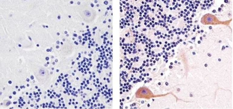 Immunohistochemistry (Formalin/PFA-fixed paraffin-embedded sections) - Anti-PKC gamma (phospho T674) antibody (AB5797)