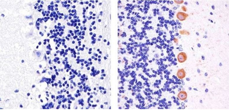 Immunohistochemistry (Formalin/PFA-fixed paraffin-embedded sections) - Anti-PKC gamma (phospho T674) antibody (AB5797)