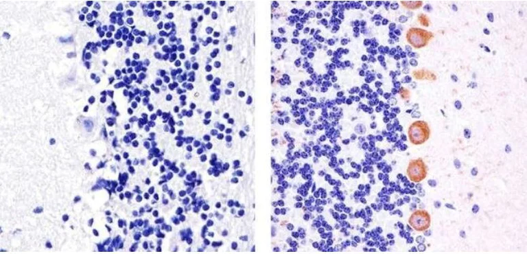 Immunohistochemistry (Formalin/PFA-fixed paraffin-embedded sections) - Anti-PKC gamma (phospho T674) antibody (AB5797)