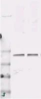 Western blot - Anti-PKC gamma (phospho T674) antibody (AB5797)