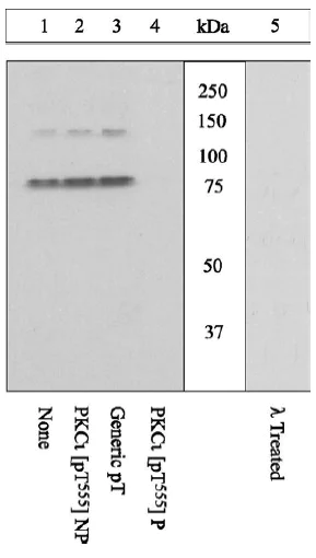 Western blot - Anti-PKC iota (phospho T555 + T563) antibody (AB5813)