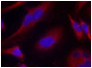 Immunocytochemistry/ Immunofluorescence - Anti-PKC mu/PKD antibody (AB131460)