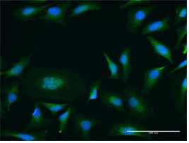 Immunocytochemistry/ Immunofluorescence - Anti-PKC mu/PKD antibody (AB172096)