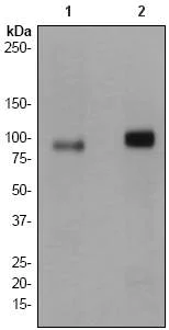 Western blot - Anti-PKC mu/PKD antibody [EP1493Y] (AB51246)