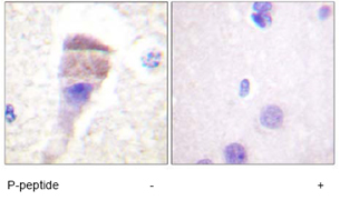 Immunohistochemistry (Formalin/PFA-fixed paraffin-embedded sections) - Anti-PKC mu/PKD (phospho S205) antibody (AB59413)