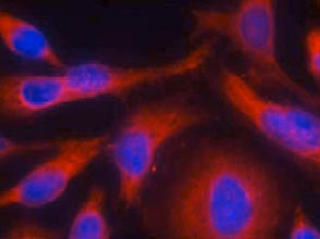 Immunocytochemistry/ Immunofluorescence - Anti-PKC mu/PKD (phospho S738) antibody (AB131101)