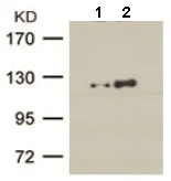 Western blot - Anti-PKC mu/PKD (phospho S738) antibody (AB131101)