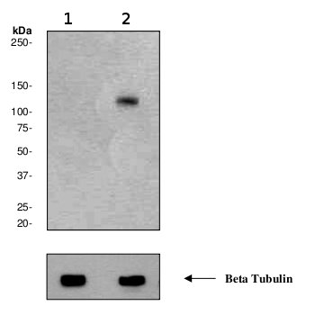 Western blot - Anti-PKC mu/PKD (phospho S738 + S742) antibody [EP1493-62] (AB75878), expandable thumbnail