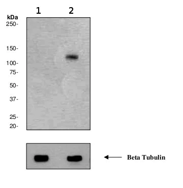Western blot - Anti-PKC mu/PKD (phospho S738 + S742) antibody [EP1493-62] - BSA and Azide free (AB247414)