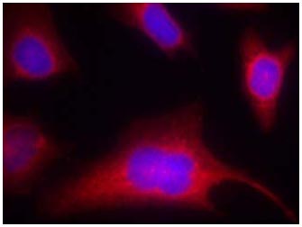 Immunocytochemistry/ Immunofluorescence - Anti-PKC mu/PKD (phospho S910) antibody (AB131267)