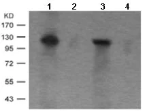 Western blot - Anti-PKC mu/PKD (phospho S910) antibody (AB131267)