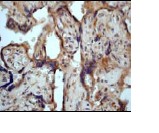 Immunohistochemistry (Formalin/PFA-fixed paraffin-embedded sections) - Anti-PKC mu/PKD (phospho S916) antibody [EP1494Y] (AB81218)