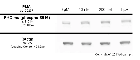 Functional Studies - Anti-PKC mu/PKD (phospho S916) antibody [EP1494Y] - BSA and Azide free (AB284765)