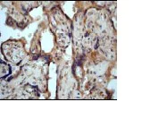 Immunohistochemistry (Formalin/PFA-fixed paraffin-embedded sections) - Anti-PKC mu/PKD (phospho S916) antibody [EP1494Y] - BSA and Azide free (AB284765)