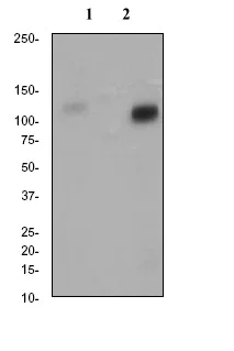 Western blot - Anti-PKC mu/PKD (phospho S916) antibody [EP1494Y] - BSA and Azide free (AB284765)