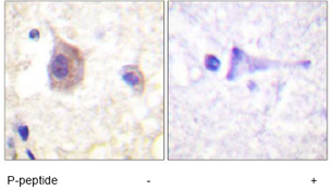 Immunohistochemistry (Formalin/PFA-fixed paraffin-embedded sections) - Anti-PKC mu/PKD (phospho Y463) antibody (AB59415)