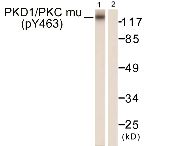 Western blot - Anti-PKC mu/PKD (phospho Y463) antibody (AB59415)