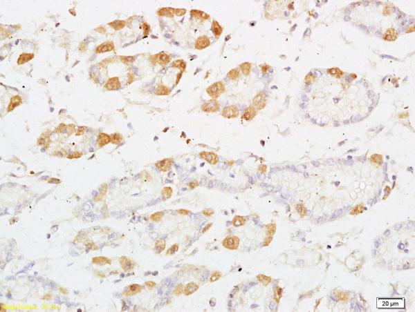 Immunohistochemistry (Formalin/PFA-fixed paraffin-embedded sections) - Anti-PKC nu/PRKD3 antibody (AB203188)