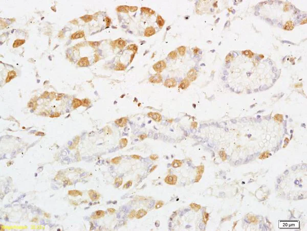 Immunohistochemistry (Formalin/PFA-fixed paraffin-embedded sections) - Anti-PKC nu/PRKD3 antibody (AB203188)