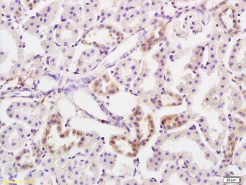 Immunohistochemistry (Formalin/PFA-fixed paraffin-embedded sections) - Anti-PKC nu/PRKD3 antibody (AB203188)