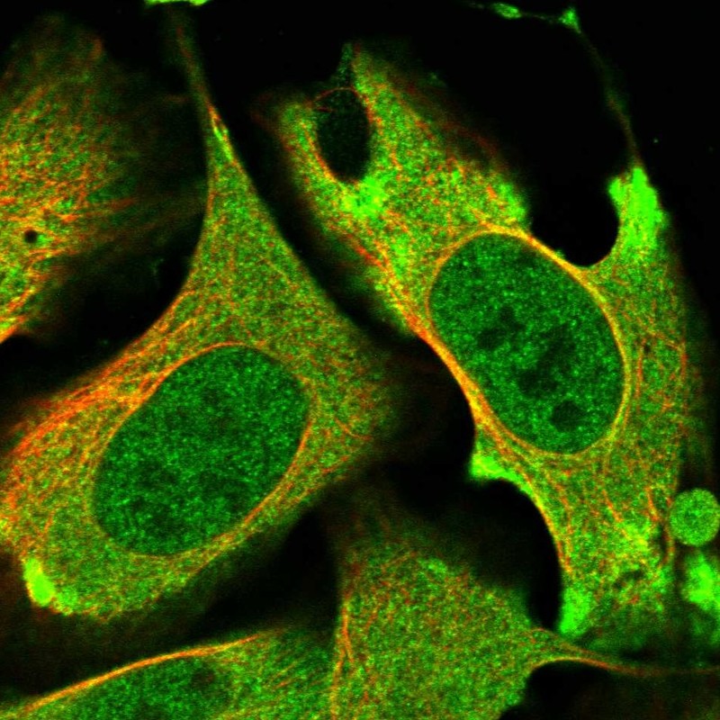 Immunocytochemistry/ Immunofluorescence - Anti-PKC nu/PRKD3 antibody (AB252982)